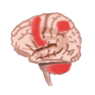 運動イメージをしたときに活性化する脳の領域を解説。運動前野、補足運動野、頭頂連合野、被殻、小脳です。